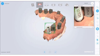 Rinascimento odontoiatrico post Covid-19