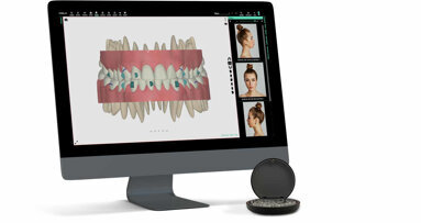 Smilers clear aligner system launches in the UK