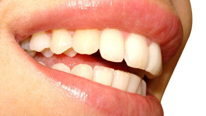 AAP calls on CDC to assess periodontal health in US AAP calls on CDC to assess periodontal health in US