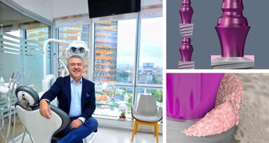 Evolution and revolution: The Bone Growth Concept