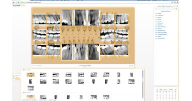 Curve Dental announces field testing of its Web-based Dental Imaging Software