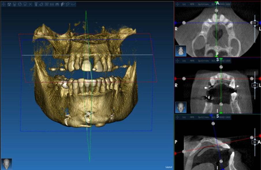 Fig. 17_Segmentazione elemento 1.5.