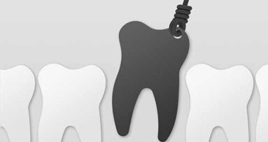 Warum wird in Deutschland so wenig implantiert?