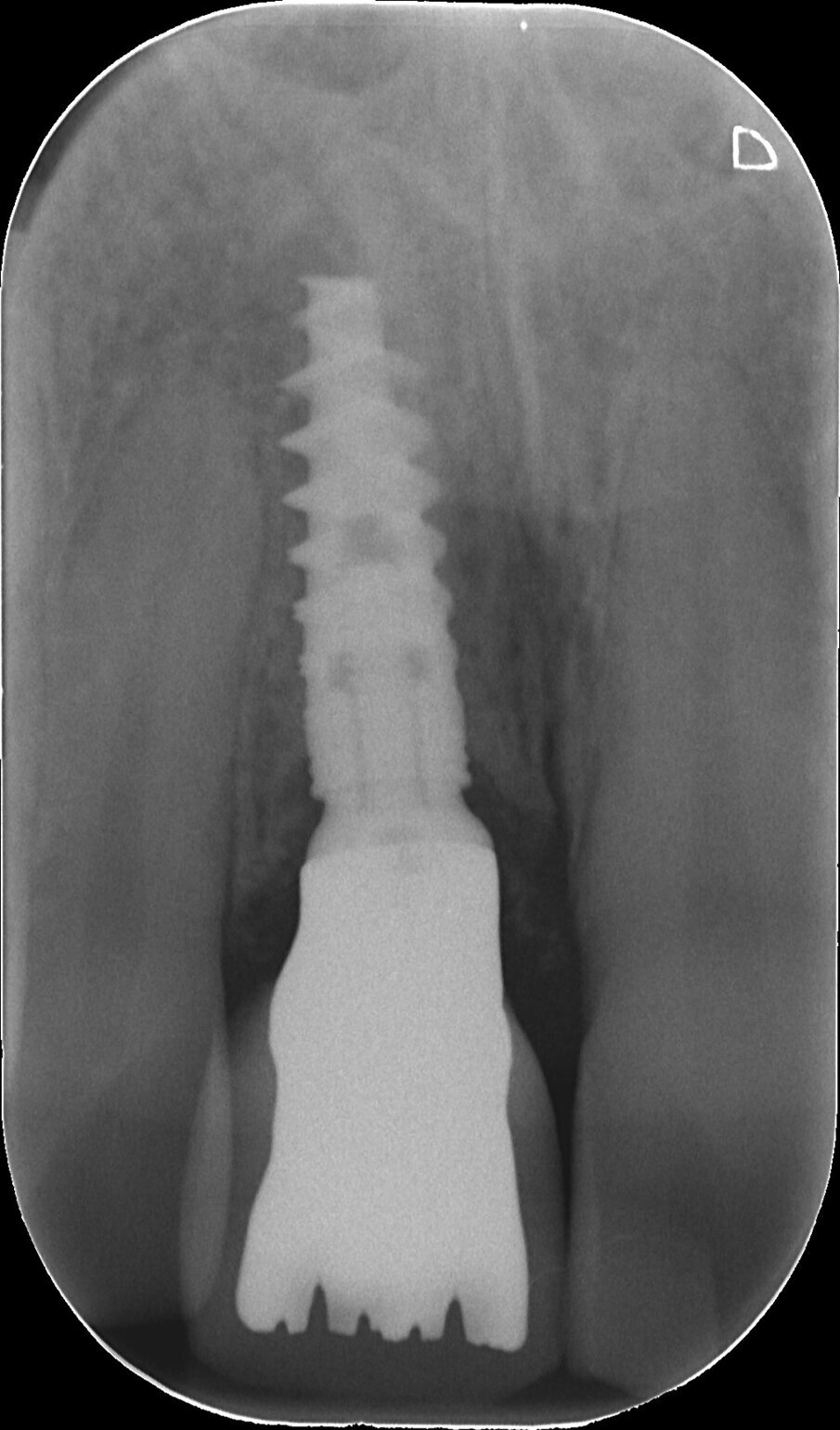 Fig. 7 - Rx fi nale.