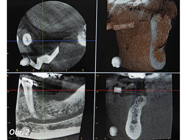 Plán ošetření byl vytvořen ihned po skenování