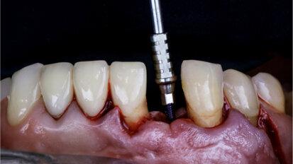 Straumann presents education highlights in May