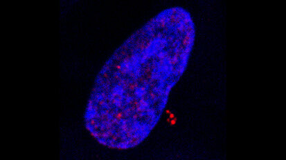 Infection par le virus d’Epstein-Barr: un nouveau mode de transformation cancéreuse