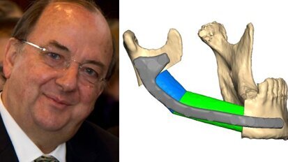 Интервю: Алтернативи на лицевите трансплантации в оралната и лицево-челюстната хирургия