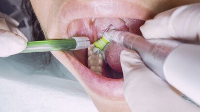 Cómo aumentar los ingresos de la consulta