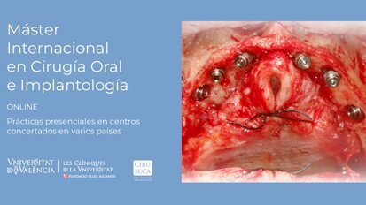Primer Máster Internacional ONLINE en Cirugía Oral e lmplantología
