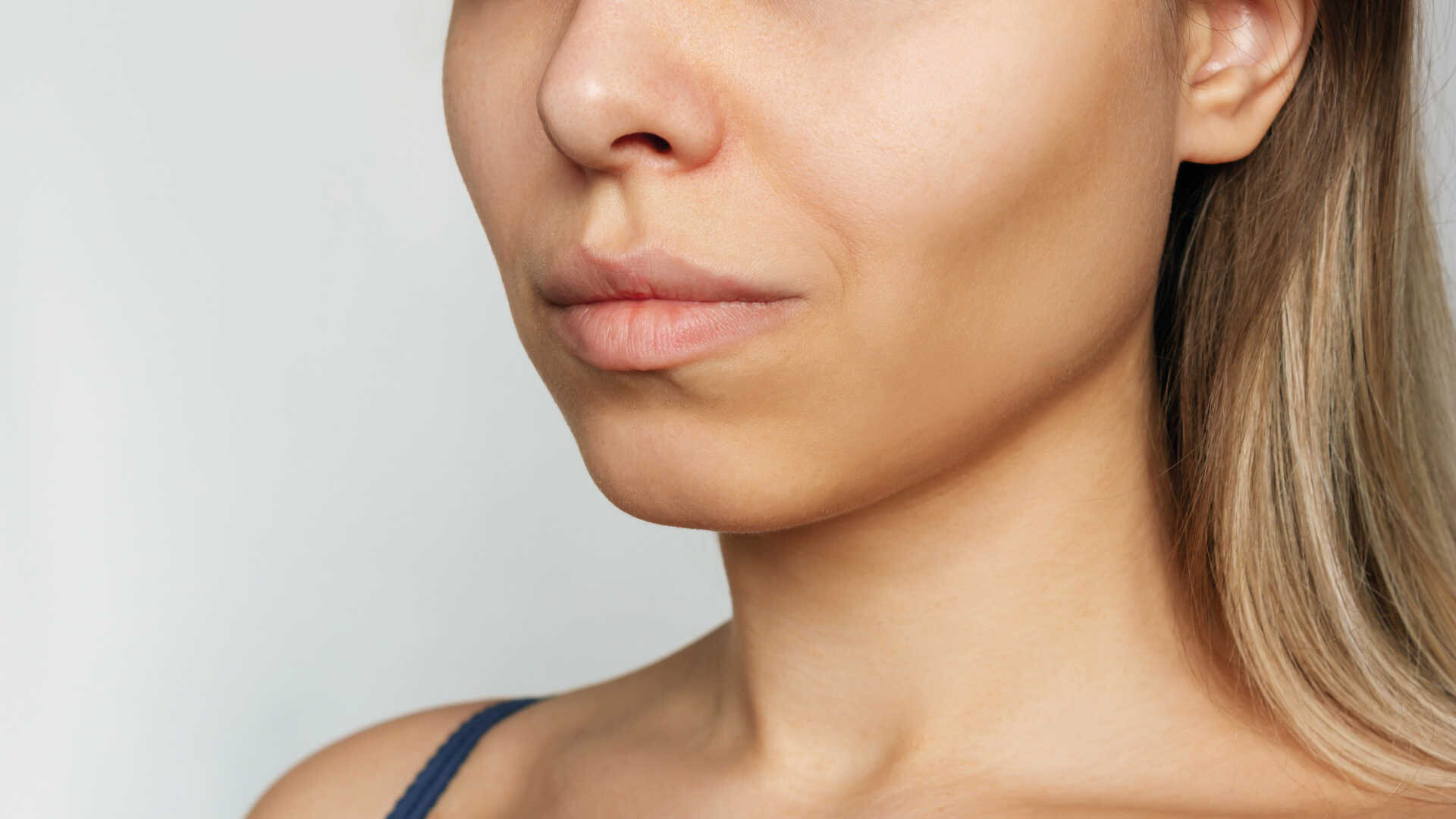 La bichectomie à visée esthétique