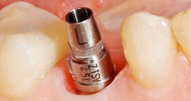 CEREC-Webinar: Klinische Aspekte des digitalen implantologischen Workflows