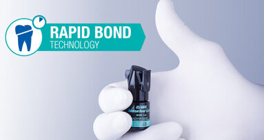 Rapid bond technology: Delivering fast-acting, long-lasting bonds