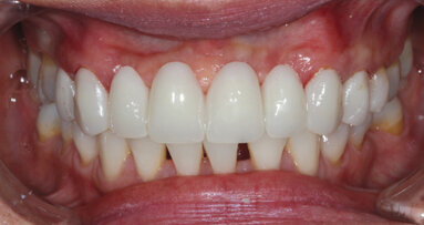 Utilizing a digital workflow for provisionalization