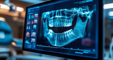 Researchers employ AI to investigate links between oral health and cardiovascular disease
