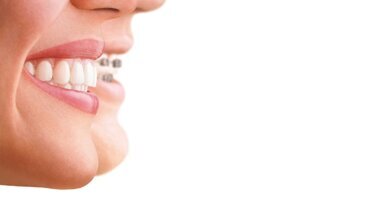 Invisalign opens first dedicated dental centre in Dubai