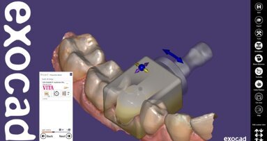 Exocad supports joint UK digital dentistry event to showcase full ChairsideCAD workflow