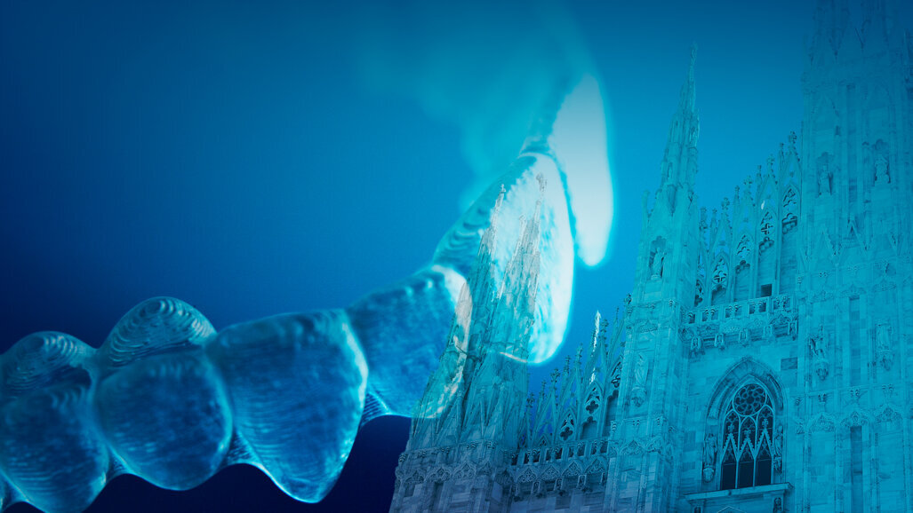 Challenges with aligners: Visioni differenti, strategie a confronto