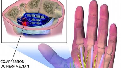 La prévention sur le bout des doigts