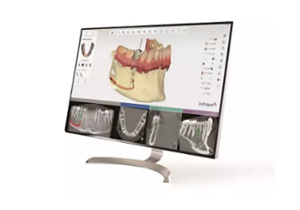 3Shape – Implant Studio