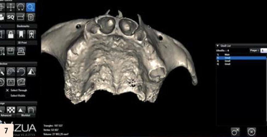 ...et avec des extractions virtuelles.