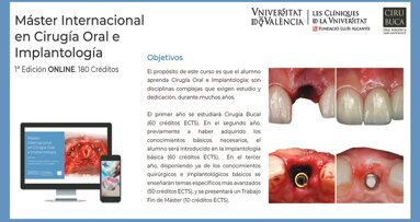 Primer Máster Internacional ONLINE en Cirugía Oral e lmplantología
