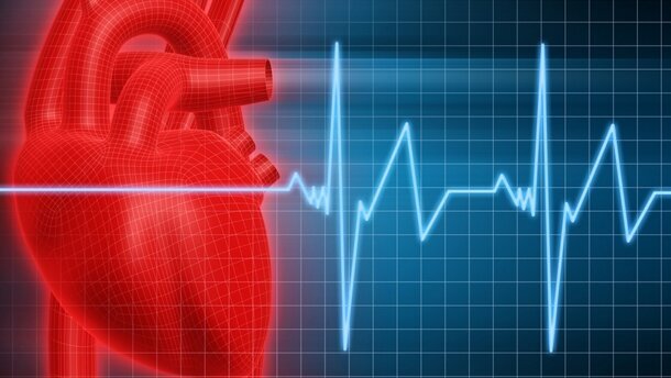 Zahnverlust erhöht das Risiko für Herzinfarkt