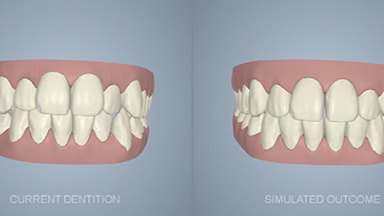 The outcome is simulated, but the wow is genuine