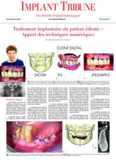 Implant Tribune France No. 2, 2024