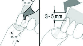 Fig. 6: The optimal positioning of the AIR-FLOW® handpiece