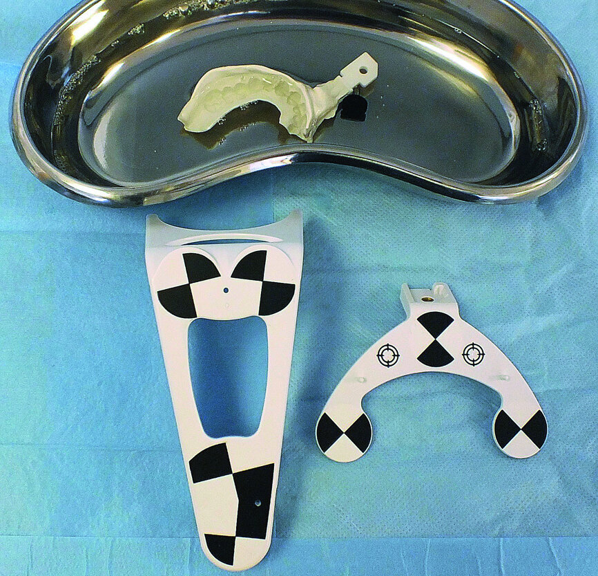 Fig. 3: Preparation of NaviStent, and drill and jaw tags immediately prior to surgery.