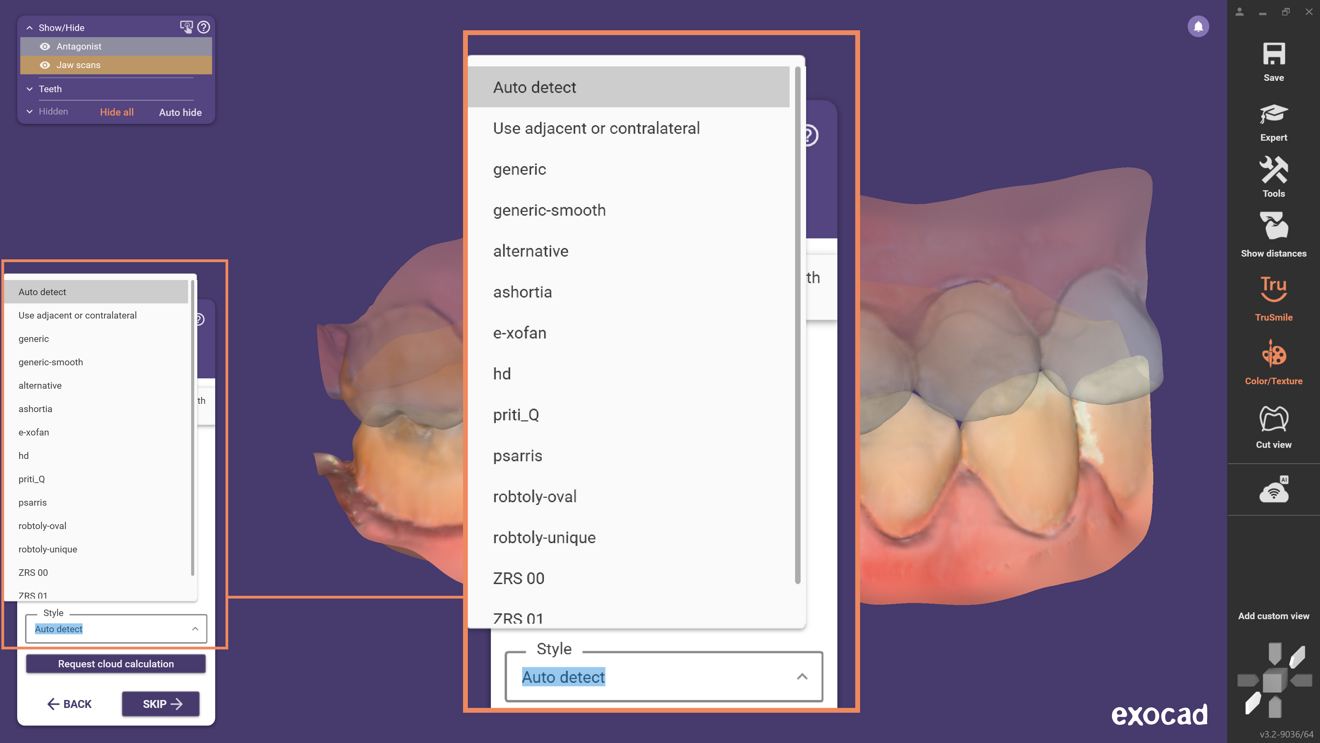 Fig. 5: In addition to multiple tooth-library styles, the AI can be constrained to remaining teeth or set to select a style automatically.