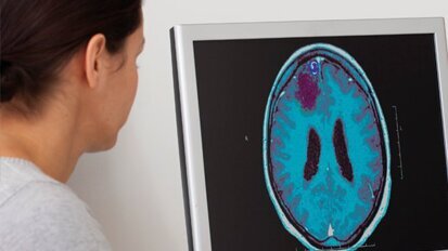 L’epilessia nel bambino: aspetti odontoiatrici e ortodontici