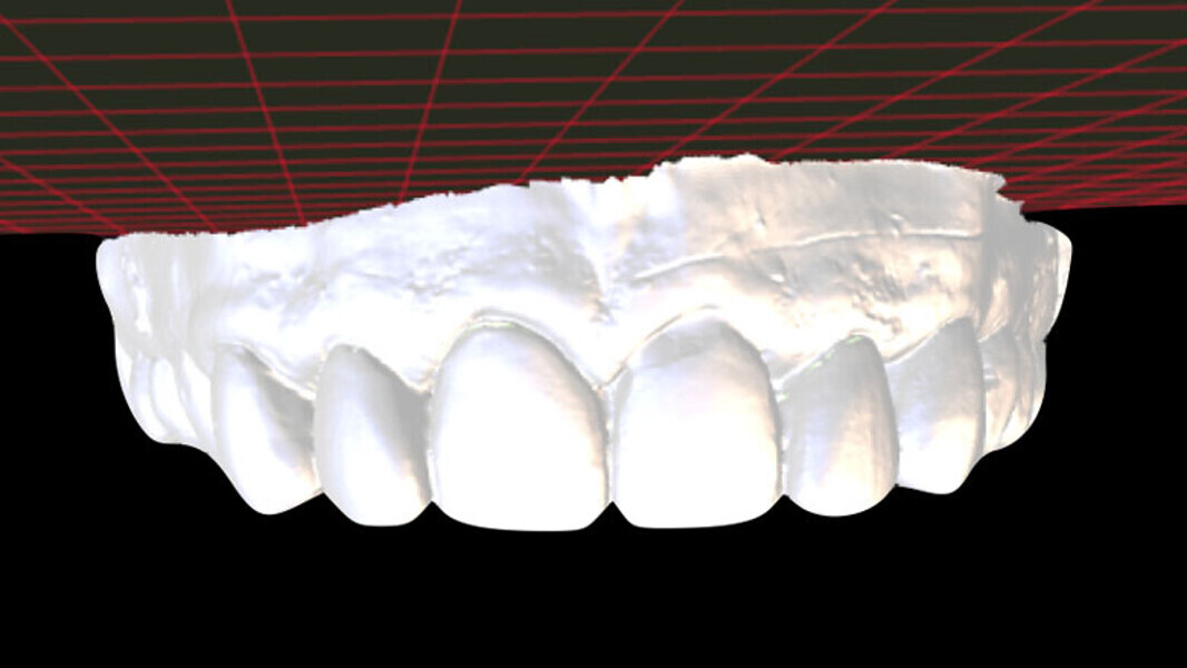 Figura 4. Wax-up digital.