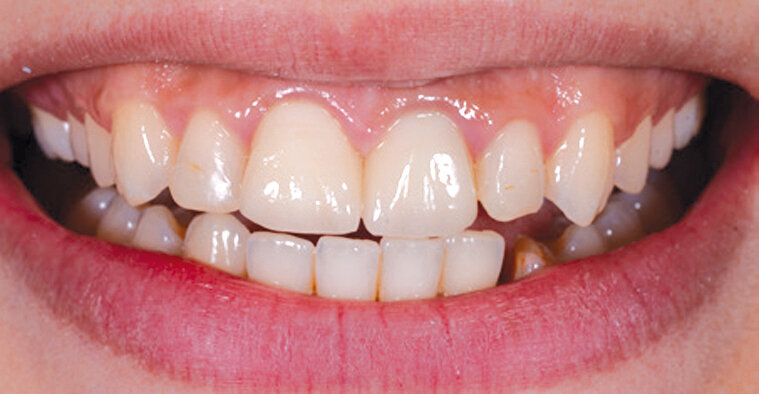 Slika 3.b Usporedba početne situacije 2015. i 2019.