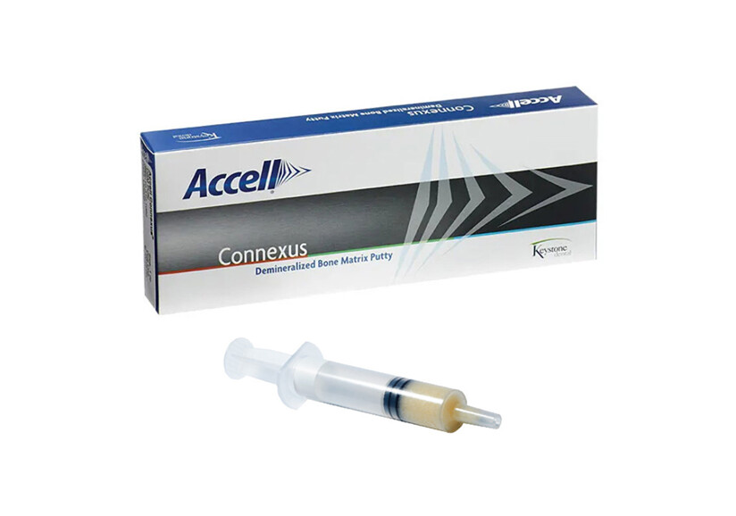 Keystone Dental Group – Accell Connexus