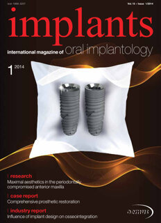 implants international No. 1, 2014 implants international No. 1, 2014