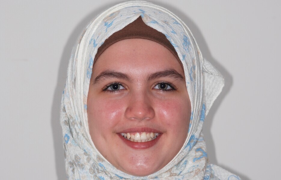 Fig. 33: Full-face frontal view before treatment.