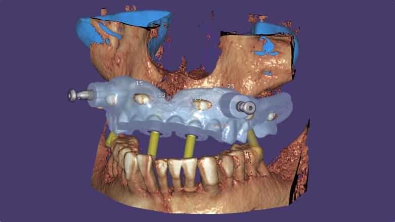 Novo exoplan 3.0 Galway agora disponível