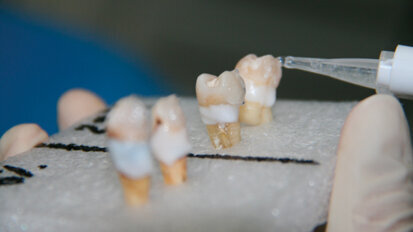 Valutazione in vitro della penetrazione di uno sbiancamento professionale