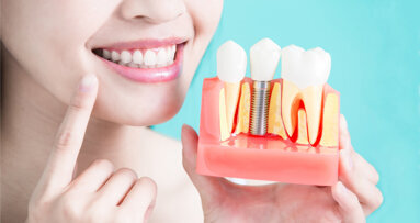 More implants for less: China rocks first-quarter results with volume-based procurement