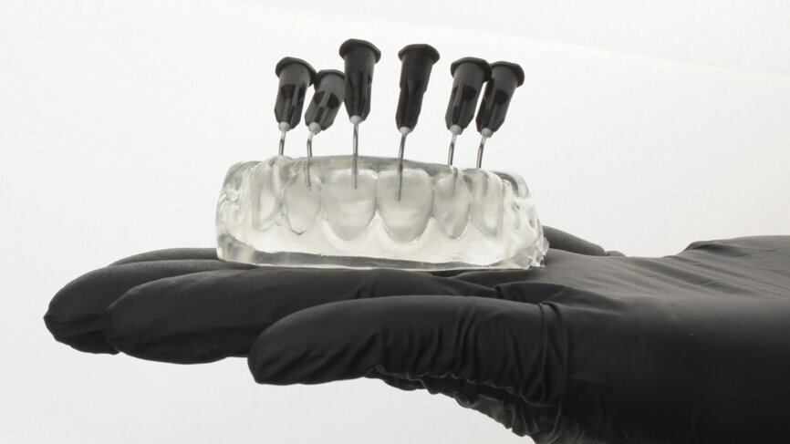 If the injection hole is too small, the index may be moved by the application tip during insertion or application, resulting in air bubbles in the restoration. (Image: Kuraray Noritake Dental) 