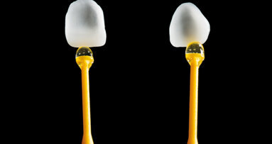 Digitální versus konvenční přístup v estetické stomatologii