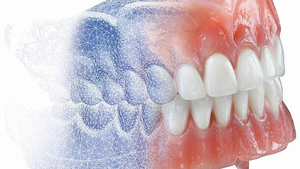 AvaDent heeft met digitale prothese de toekomst