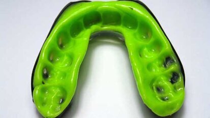 Study: Custom-made mouthguards out-perform store-bought models Study: Custom-made mouthguards out-perform store-bought models