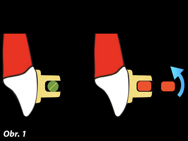 Tradiční posloupnost oblouků, která může způsobit nadměrnou protruzi korunek zubů