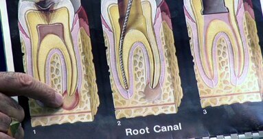 Ξεκινά την επόμενη Παρασκευή το πρώτο Συνέδριο Ενδοδοντίας και Προσθετικής