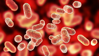 Periodontal disease and coronary artery disease share genetic basis