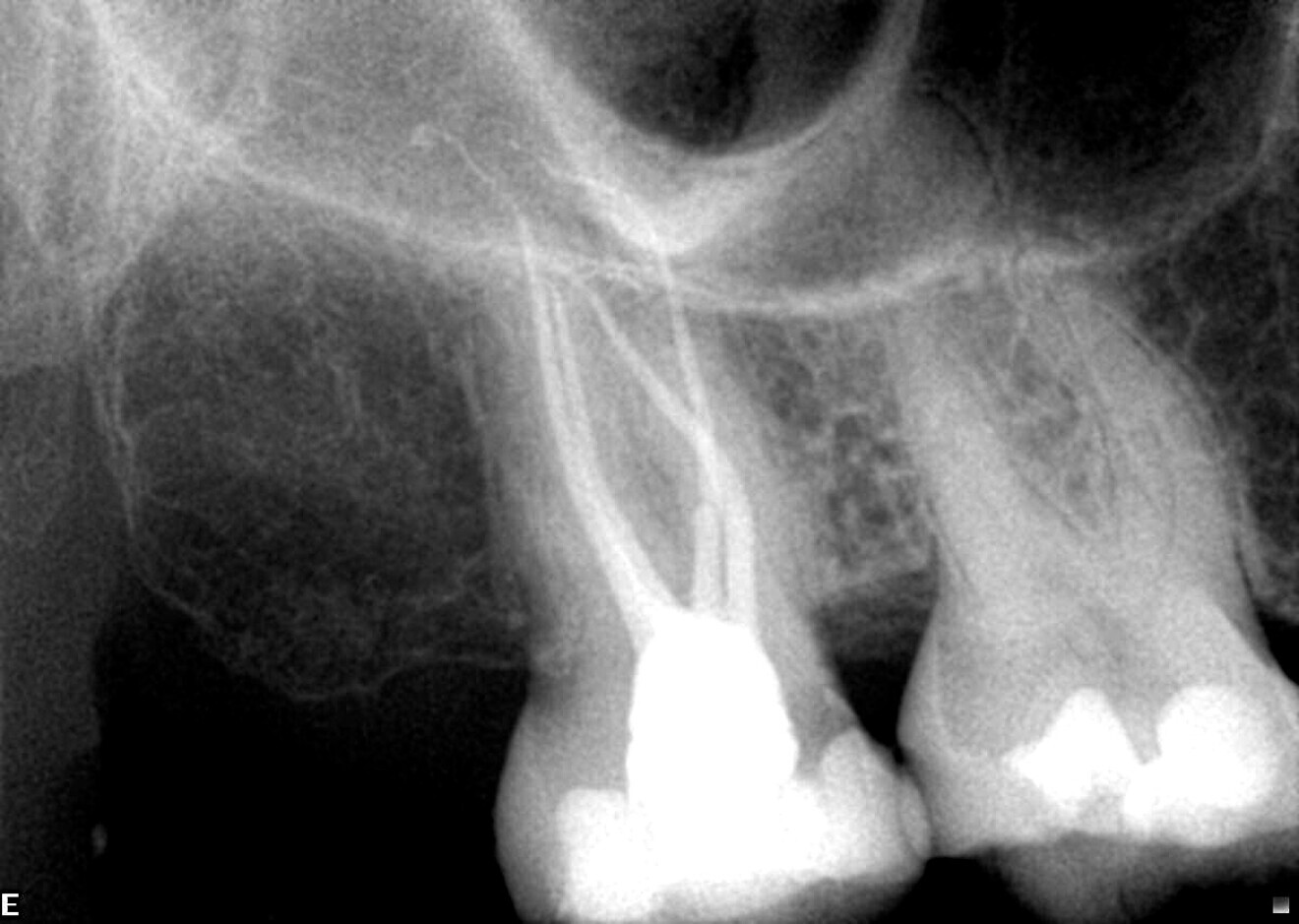 Fig. 8: Postoperative periapical radiograph.