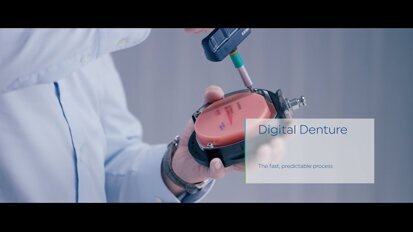 Digital Denture - The fast, predictable process